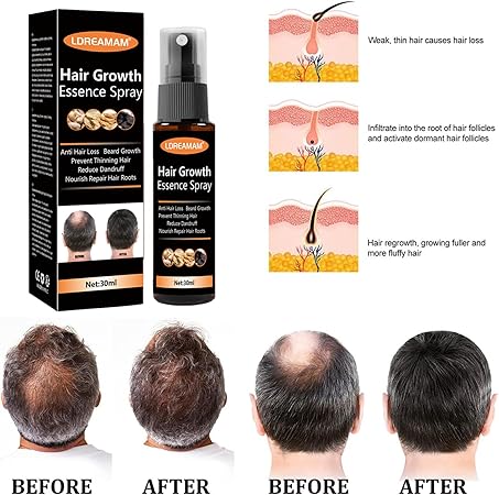 Hair Regrowth Spray (Original)