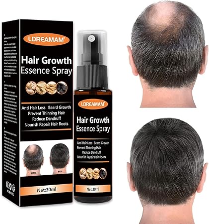 Hair Regrowth Spray (Original)