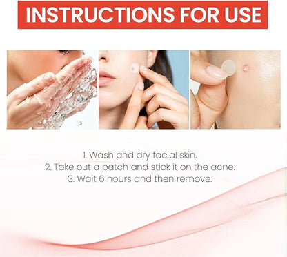 Acne Cover Patch (72pc)