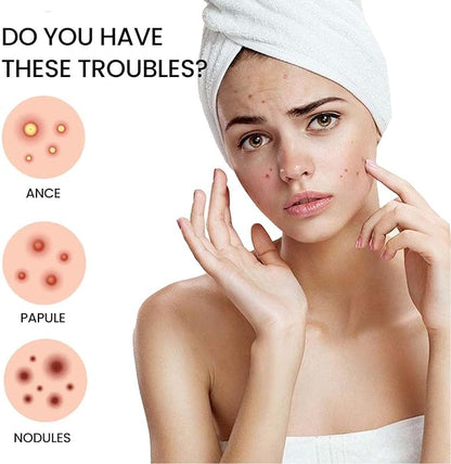 Acne Cover Patch (72pc)